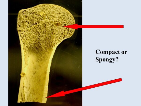 BONE CHECKUP
