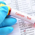 Serum Calcium