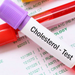 SERUM CHOLESTEROL