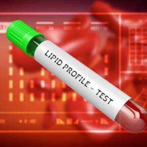LIPID PROFILE