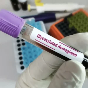 Glycosylated Hemoglobin (Hba1c)