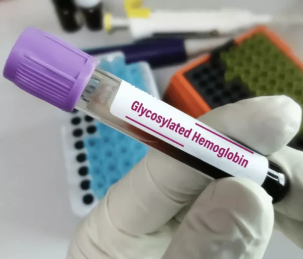 Glycosylated Hemoglobin (Hba1c)
