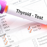 Thyroid Function Test (T3 T4 TSH)