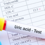 Uric Acid Test