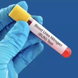 BLOOD UREA & SERUM CREATININE