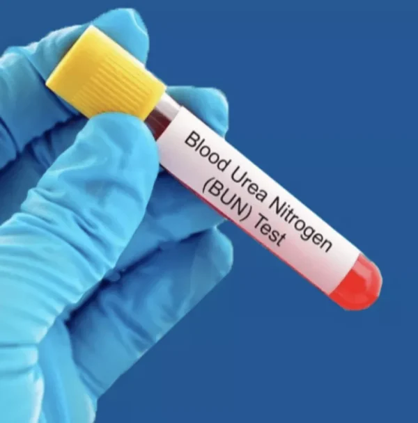 BLOOD UREA & SERUM CREATININE